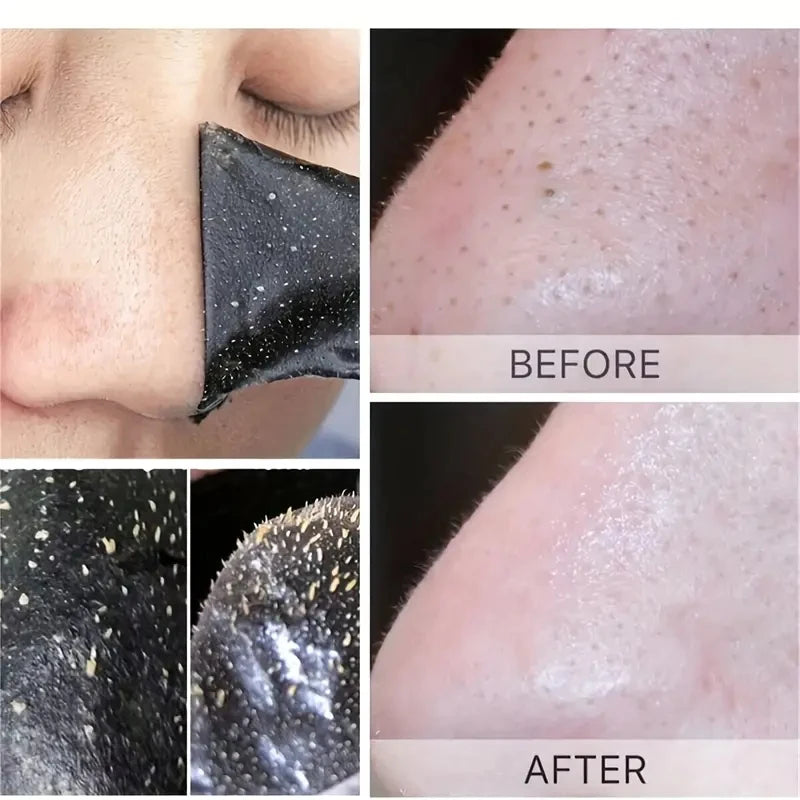 Nose Blackhead Remove Mask Plaster