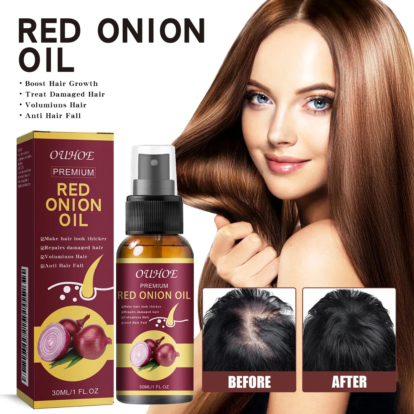 Red Onion Hair Growth Essential Oil