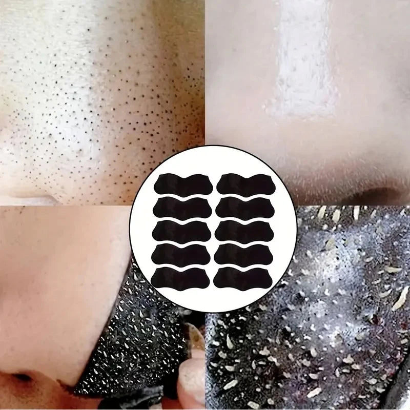 Nose Blackhead Remove Mask Plaster