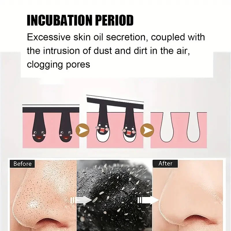 Nose Blackhead Remove Mask Plaster
