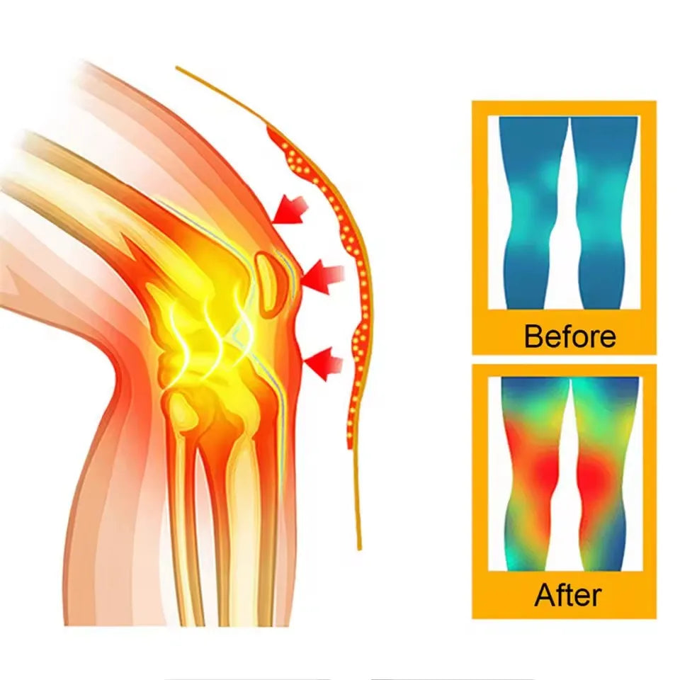 2PCS Self Heating Support Knee Pad