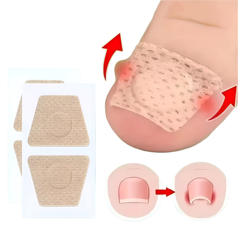 Nail Repair Patch Grey Fungal